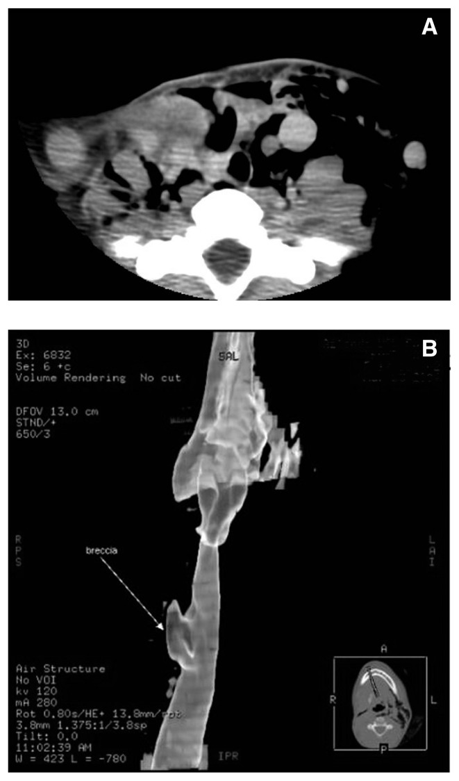 Fig. 1 A, B