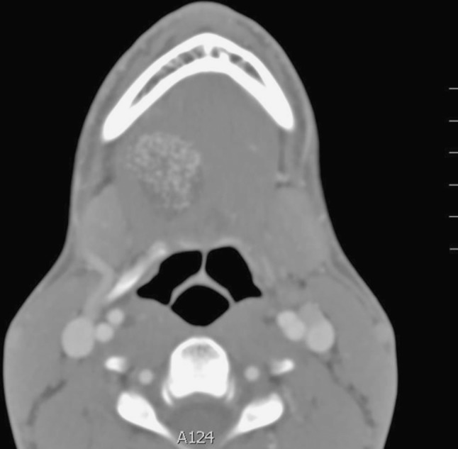 Fig. 2