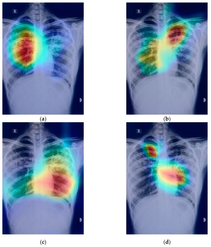 Figure 14