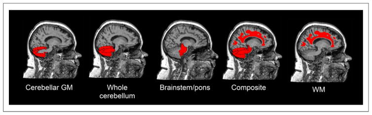 FIGURE 1