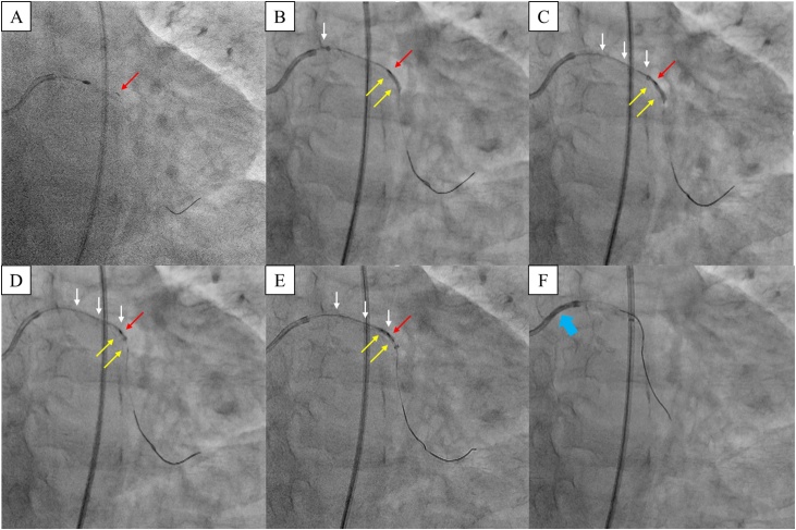 Fig. 2