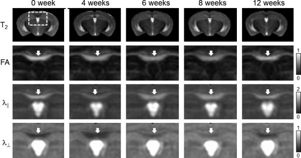 FIG. 4