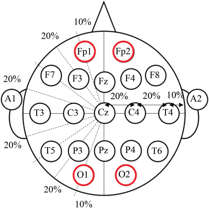 FIGURE 4