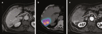 Fig. 11