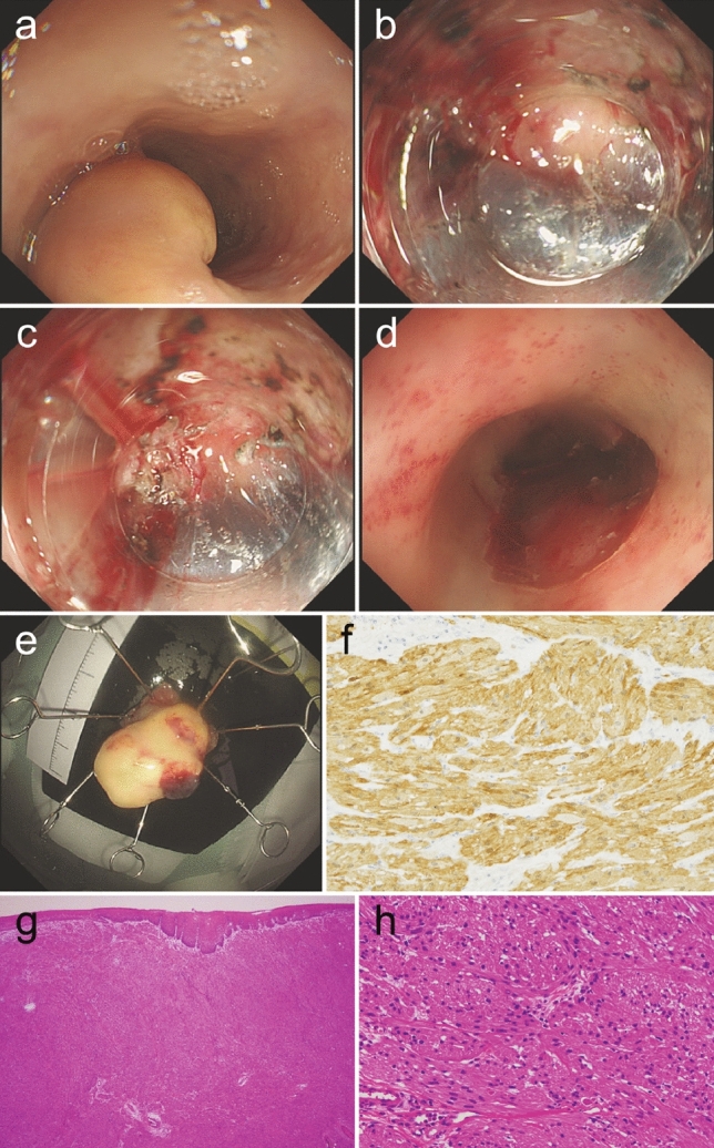 Fig. 4