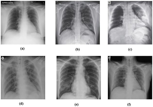 Fig 4