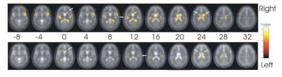 Fig. (2)