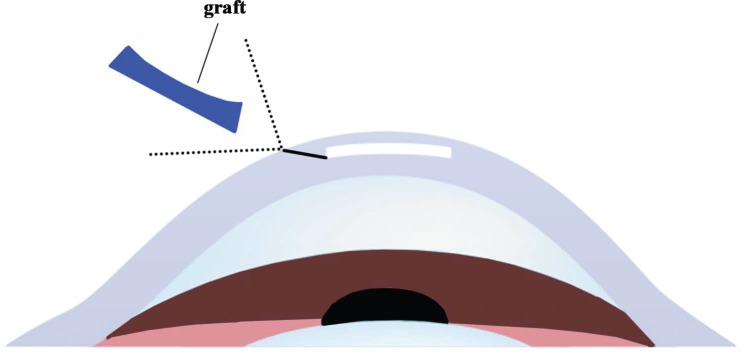 Fig. (1)