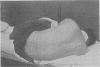 126