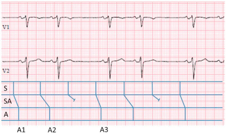 Fig. (4)