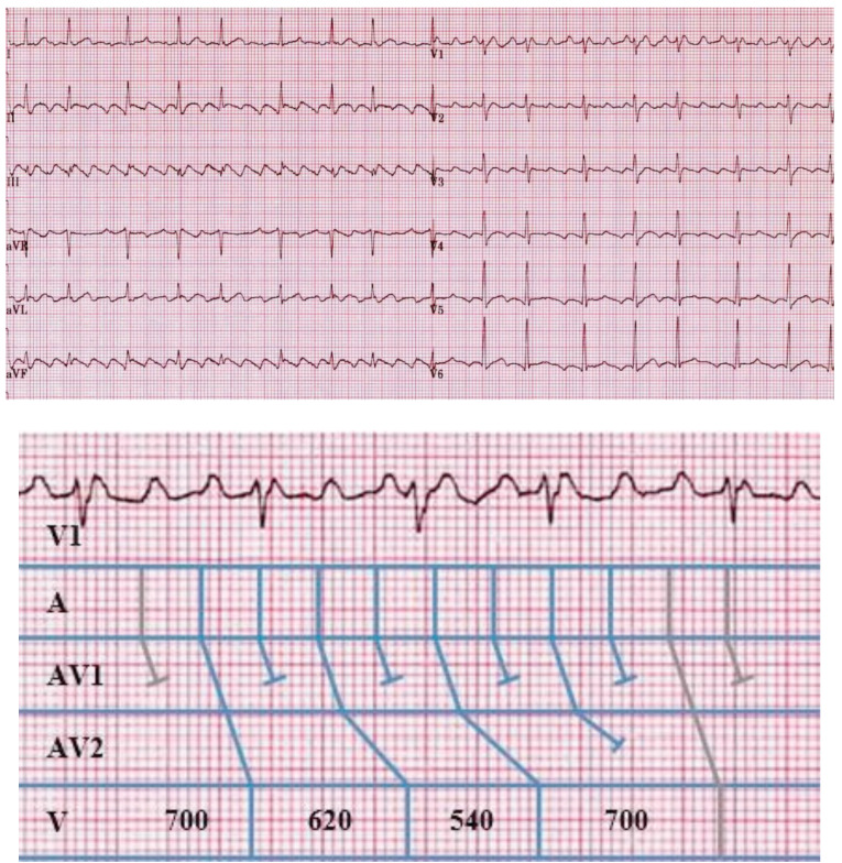 Fig. (5)