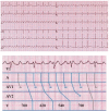 Fig. (5)
