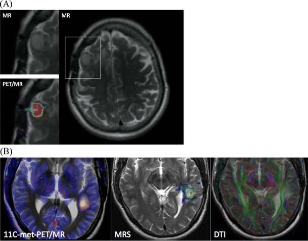 Fig. 4