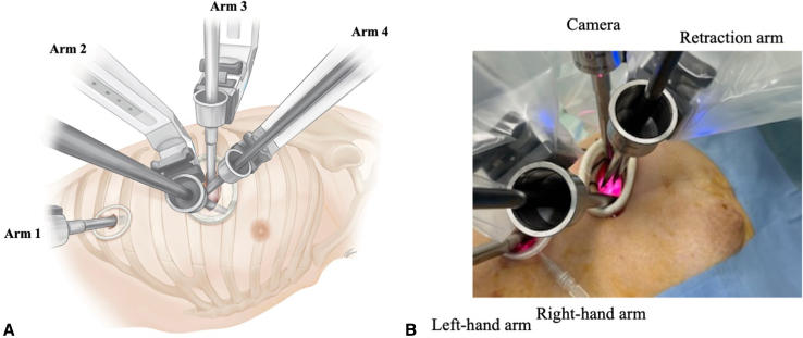 Figure 3