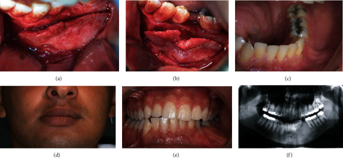 Figure 4