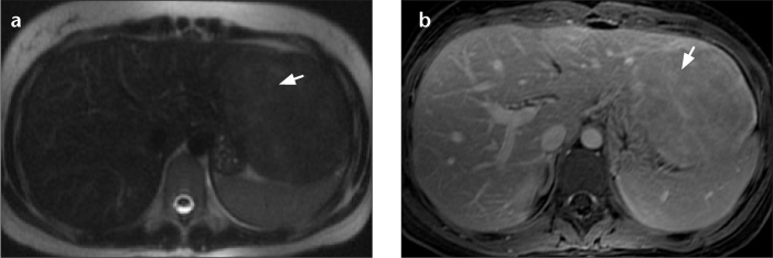 Figure 1. a, b.