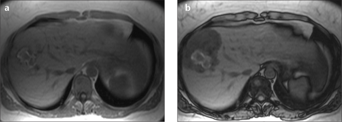 Figure 3. a, b.