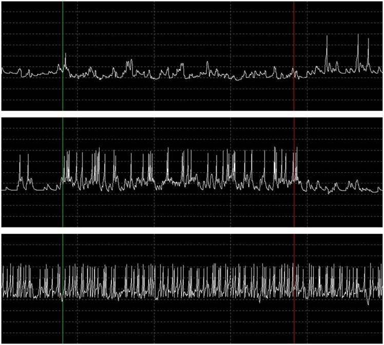 Figure 14