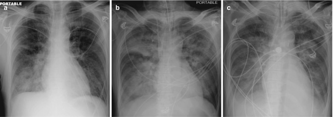 Fig. 7.6