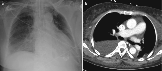 Fig. 7.16