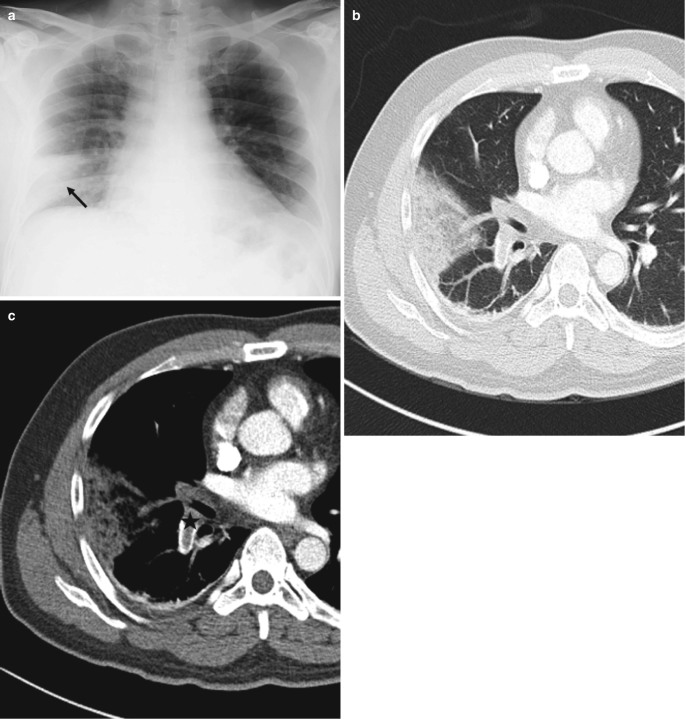 Fig. 7.12
