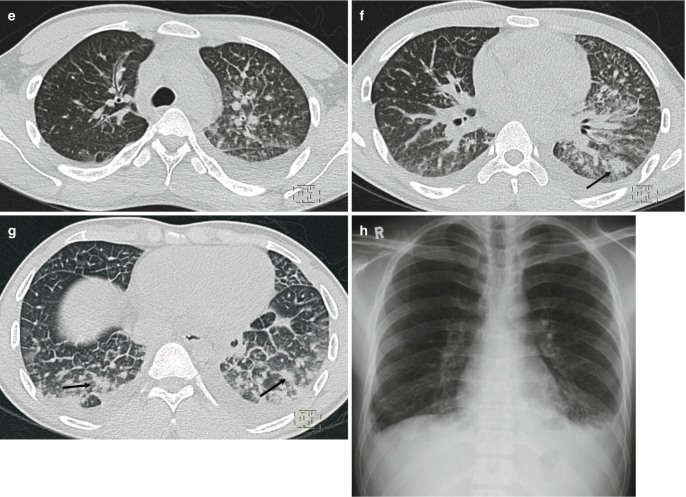 Fig. 7.2