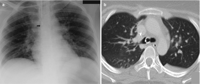 Fig. 7.18
