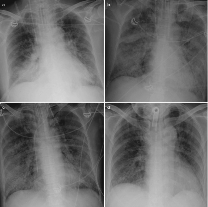 Fig. 7.5