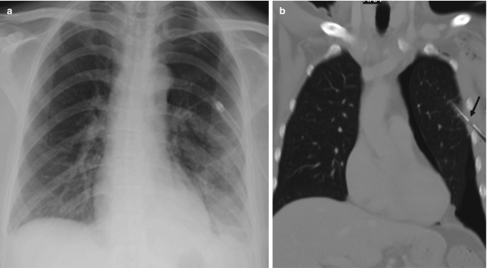 Fig. 7.24