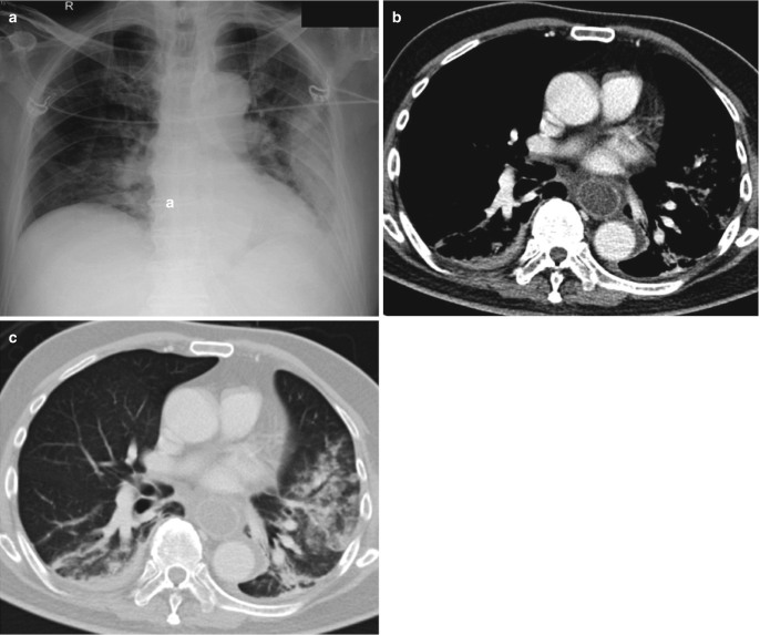 Fig. 7.10