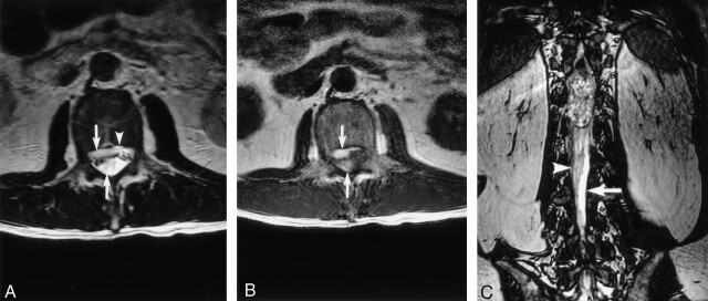 Fig 3.