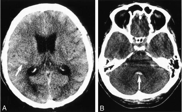 Fig 1.