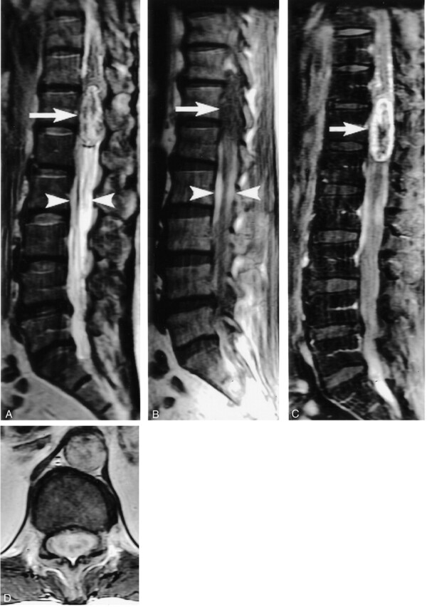 Fig 2.