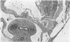 422-1