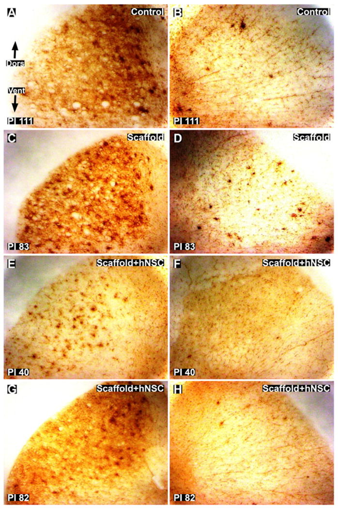 Fig. 11