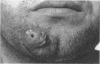 528