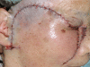 Fig. (3)