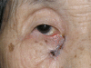 Fig. (1)