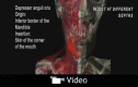 Video Graphic 1.