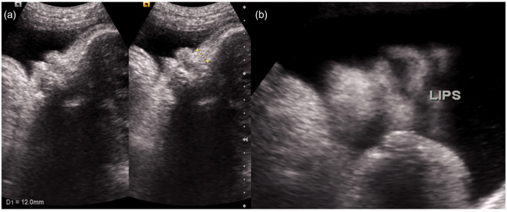 Figure 4.