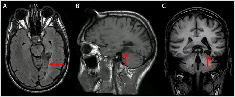 Figure 7-6.