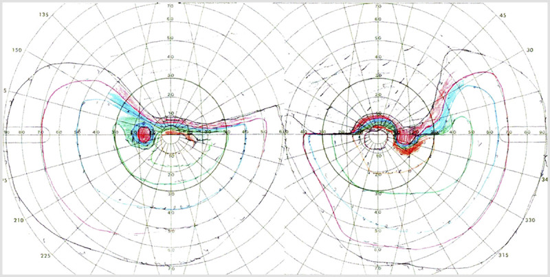 Figure 7-1.