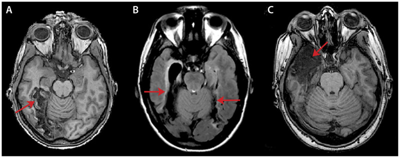 Figure 7-5.