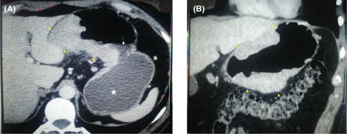 FIGURE 1