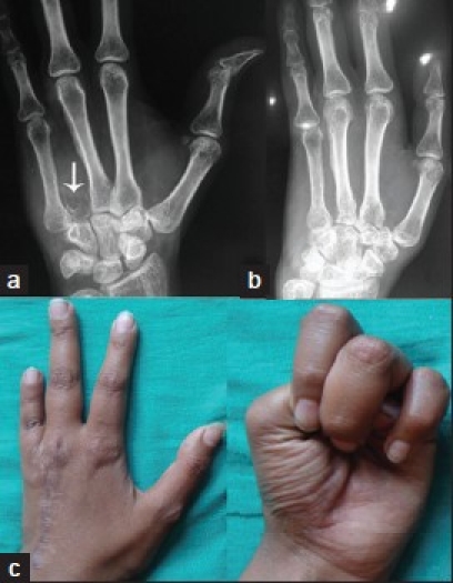 Figure 1C