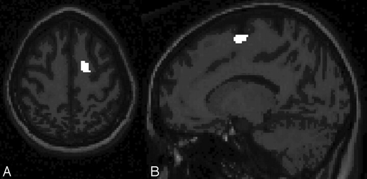 Fig 2.