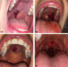 Fig 1