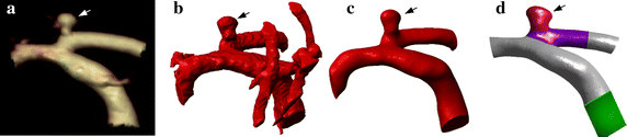 Fig. 1