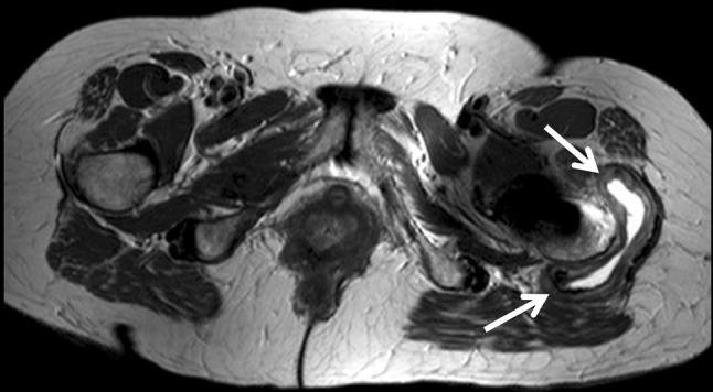 Fig. 2