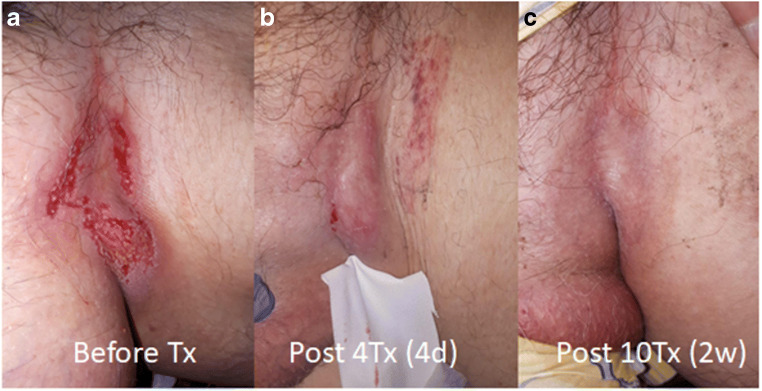 Fig. 3